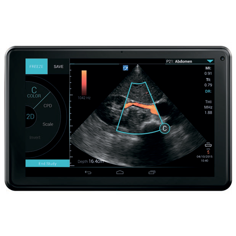 Fujifilm Sonosite iViz