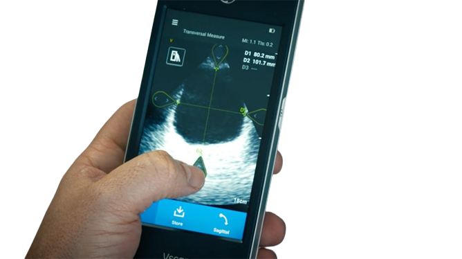 GE Healthcare Vscan