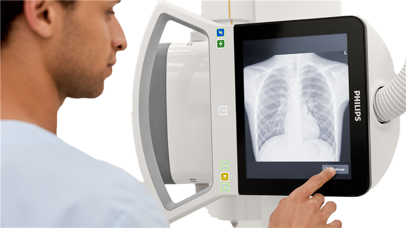 Philips Digital Diagnost C90