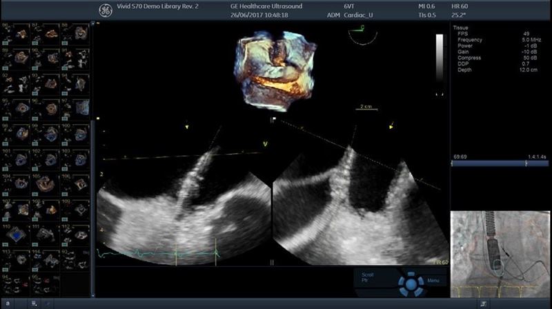 GE Healthcare Vivid S60
