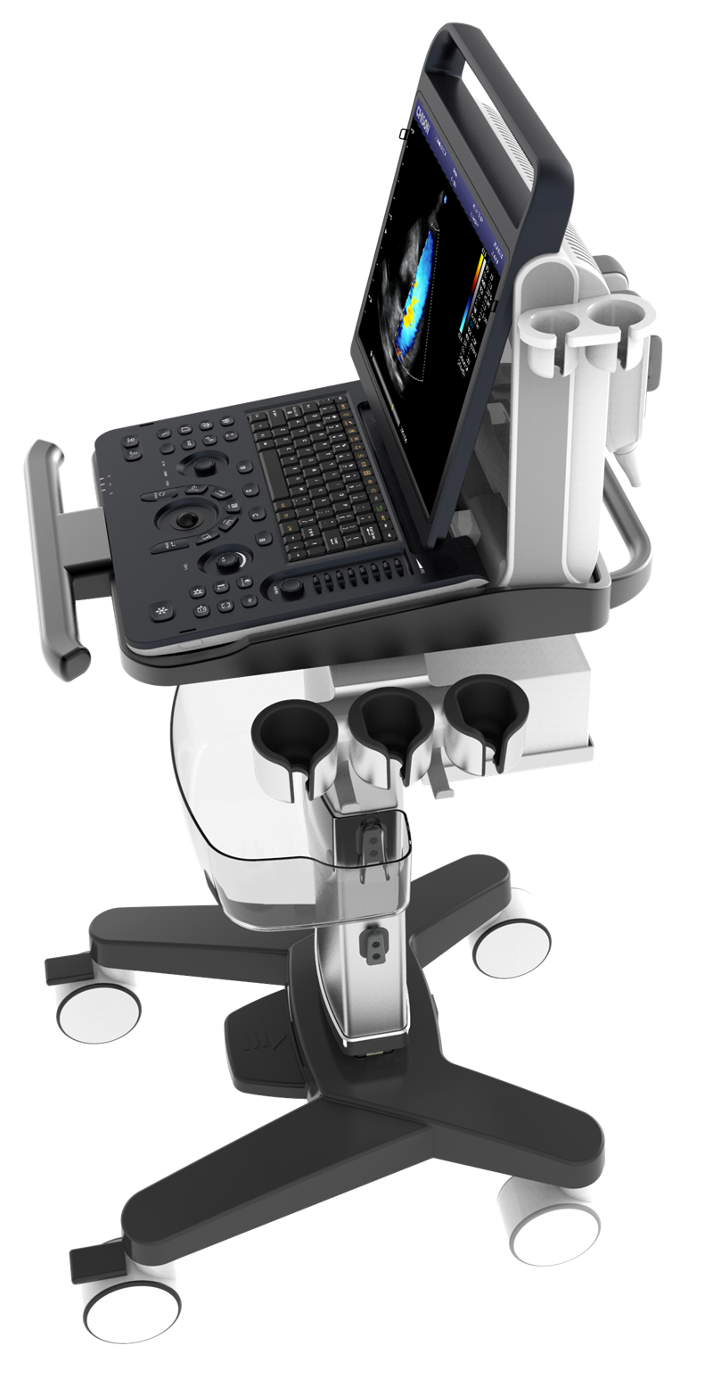 Chison SonoTouch 60 OB