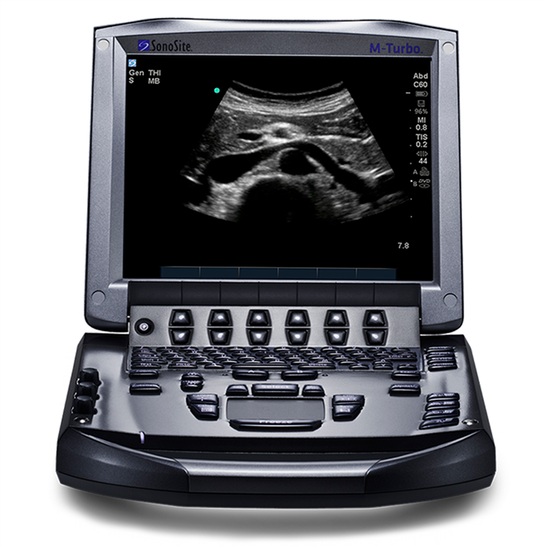 Fujifilm Sonosite M-turbo
