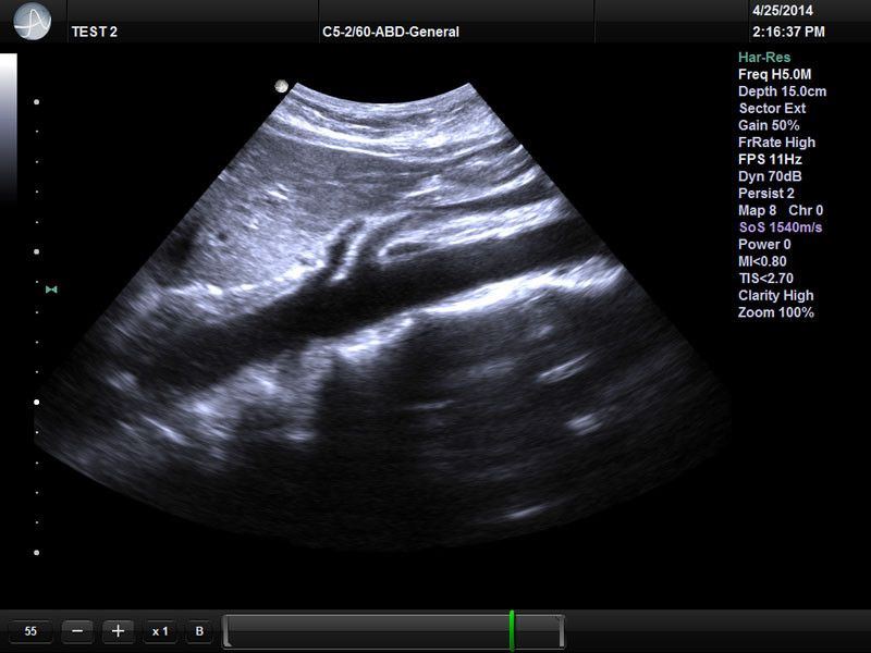 UltraSonix SonixOP