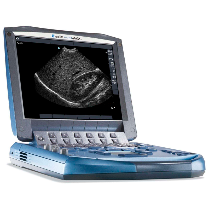 Fujifilm Sonosite Micromaxx