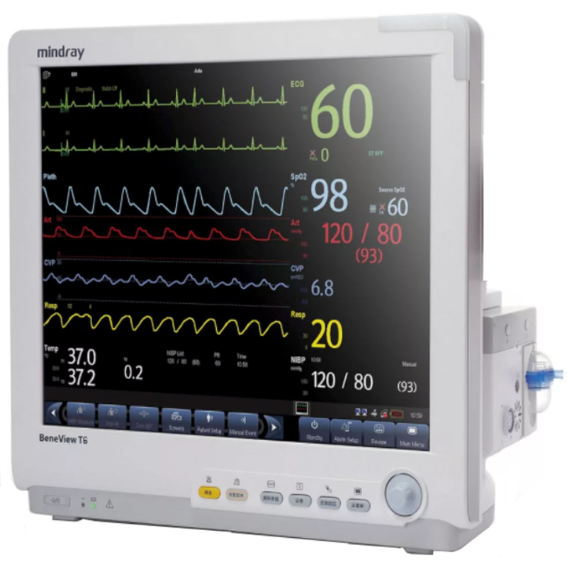 Mindray BeneView T6