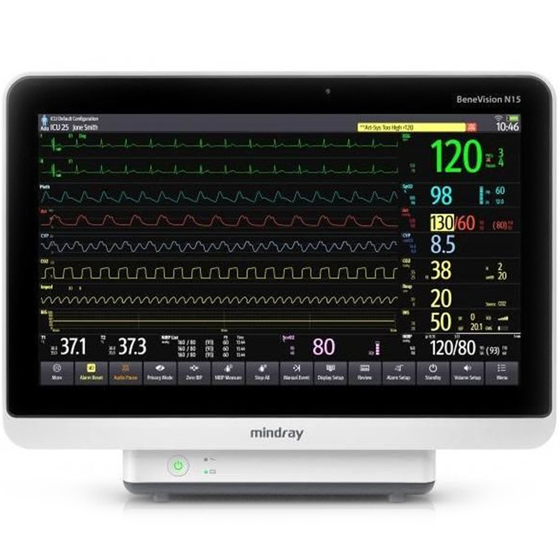Mindray BeneVision N15