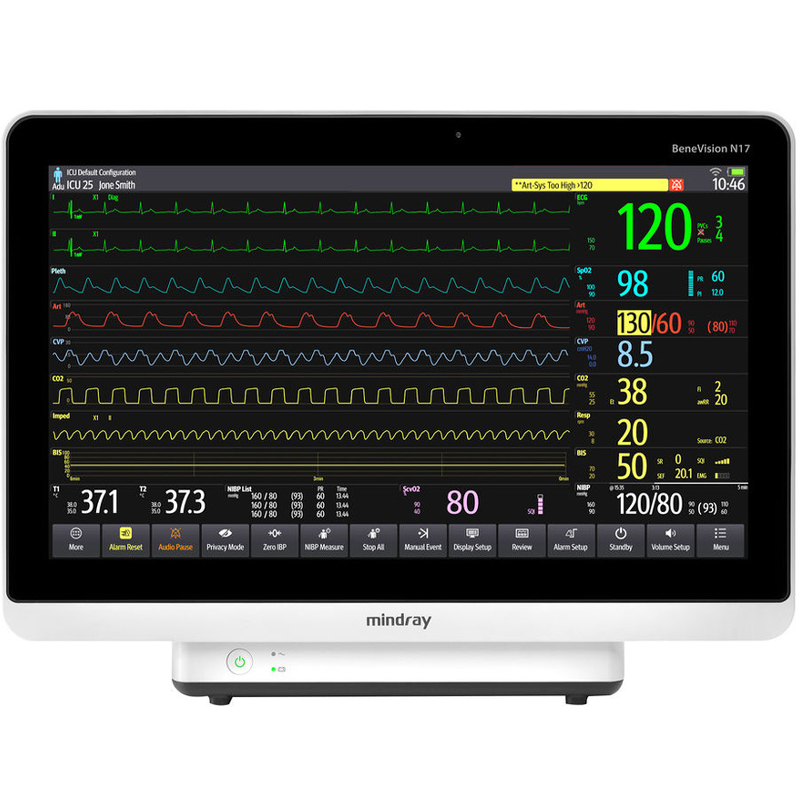Mindray BeneVision N17