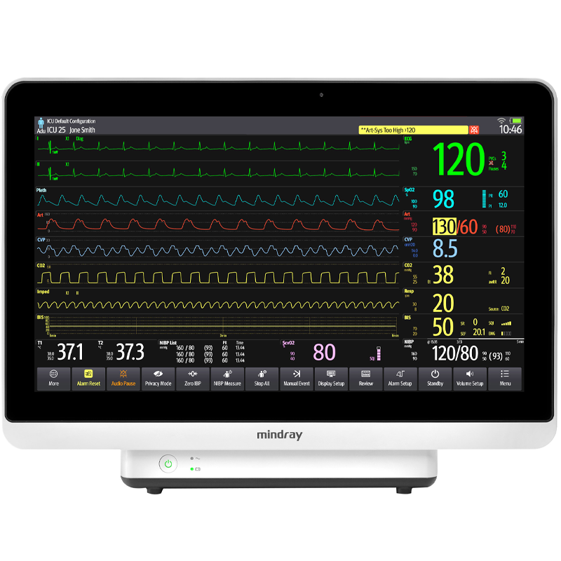 Mindray BeneVision N19