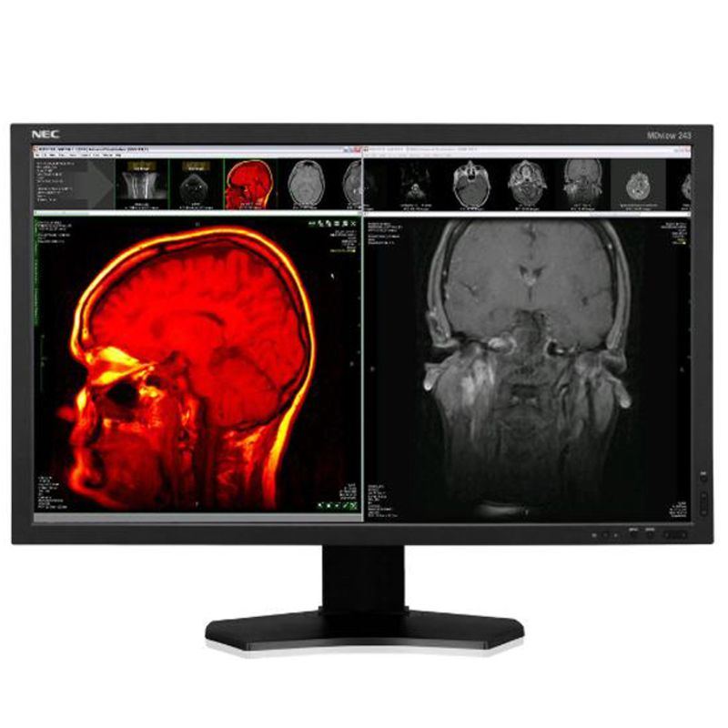 NEC MDview 243