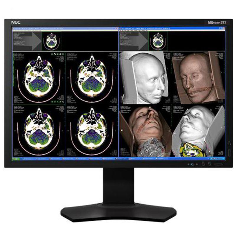 NEC MDview 272