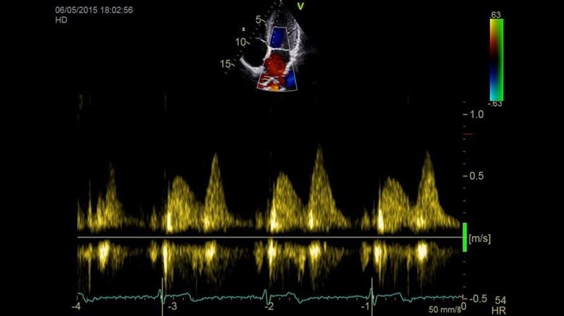 GE Healthcare Vivid IQ