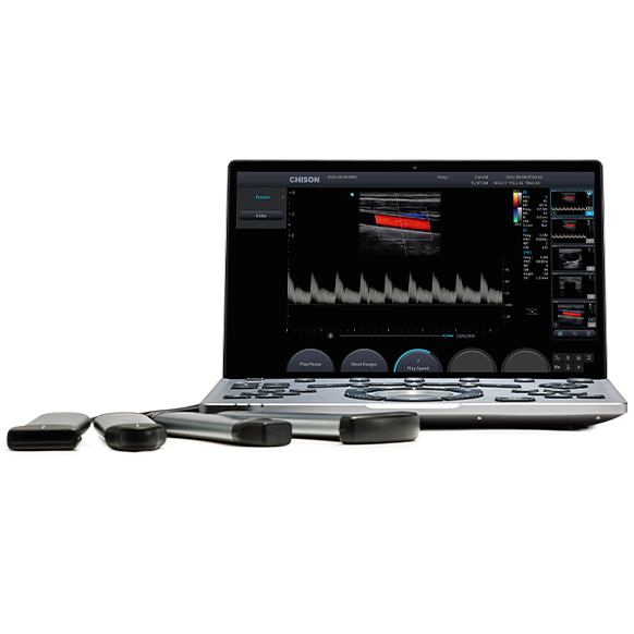 Chison Sonoair