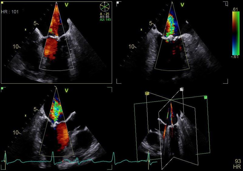 GE Healthcare Vivid S70