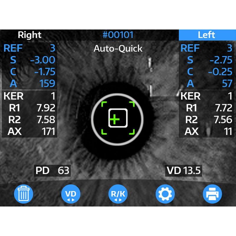 Reichert Optochek Plus