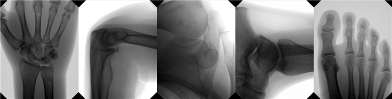 Orthoscan Mobile DI