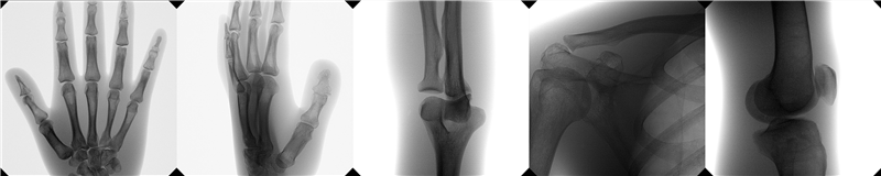 Orthoscan TAU