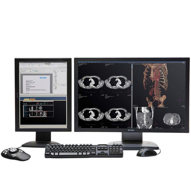 Philips IntelliSpace Portal