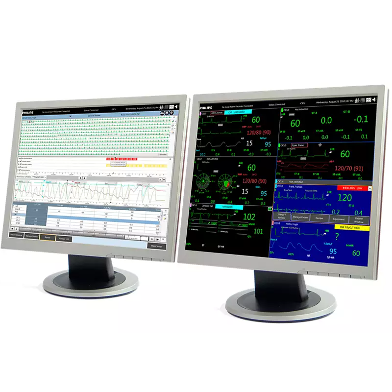 Philips IntelliVue iX