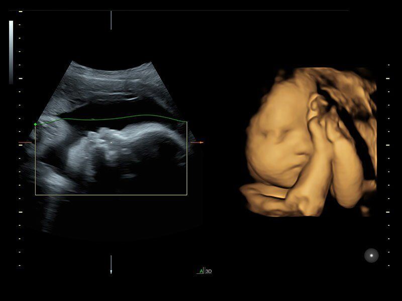 GE Healthcare Voluson S6