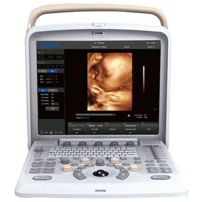 Chison q5