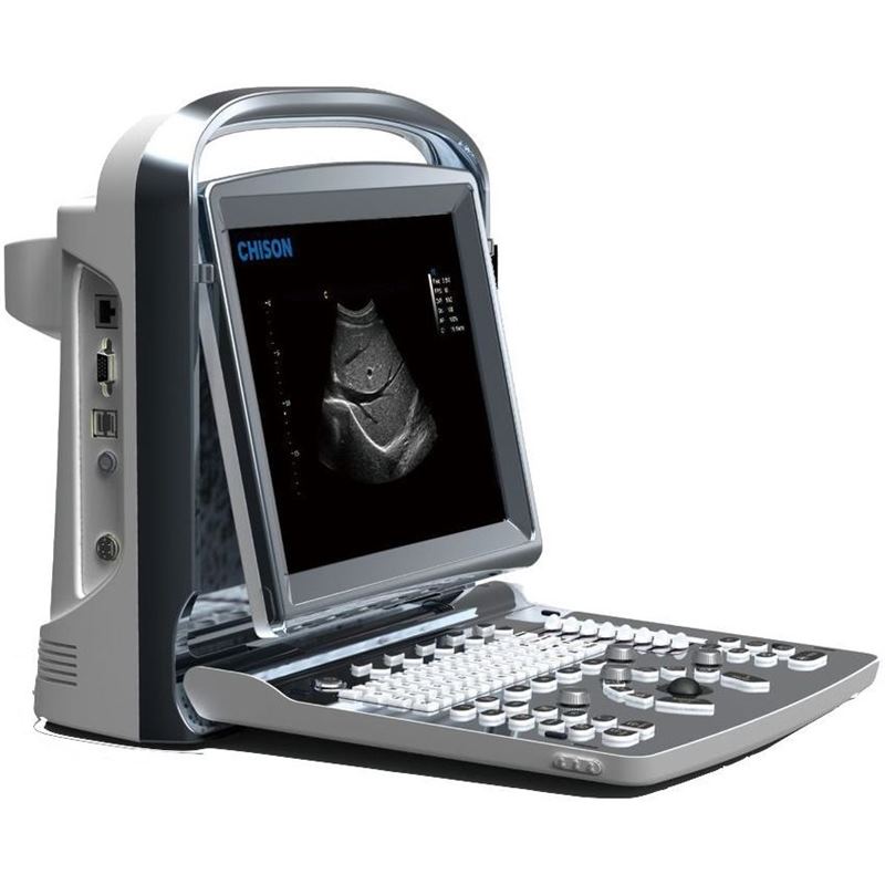 Chison SonoTouch 10