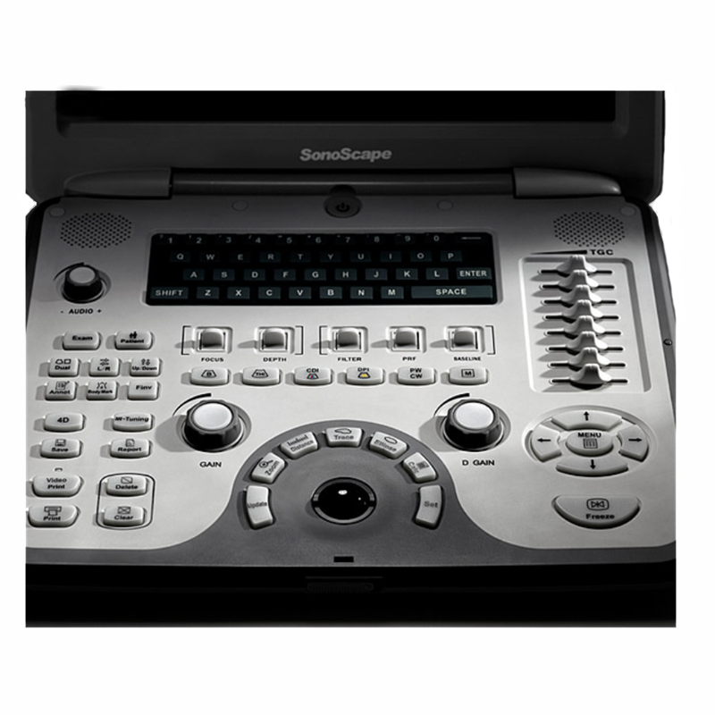 Sonoscape S6V