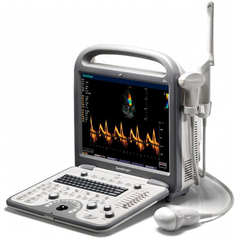 Sonoscape S8