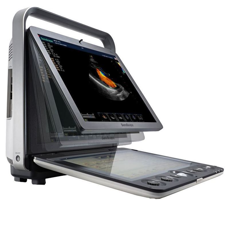 Sonoscape S9