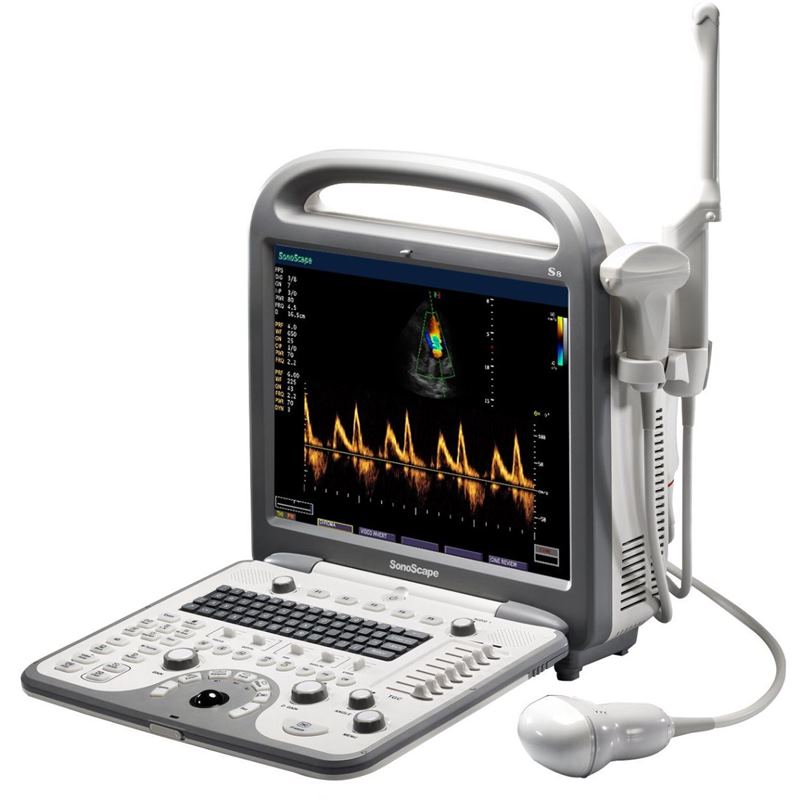 Sonoscape S8N
