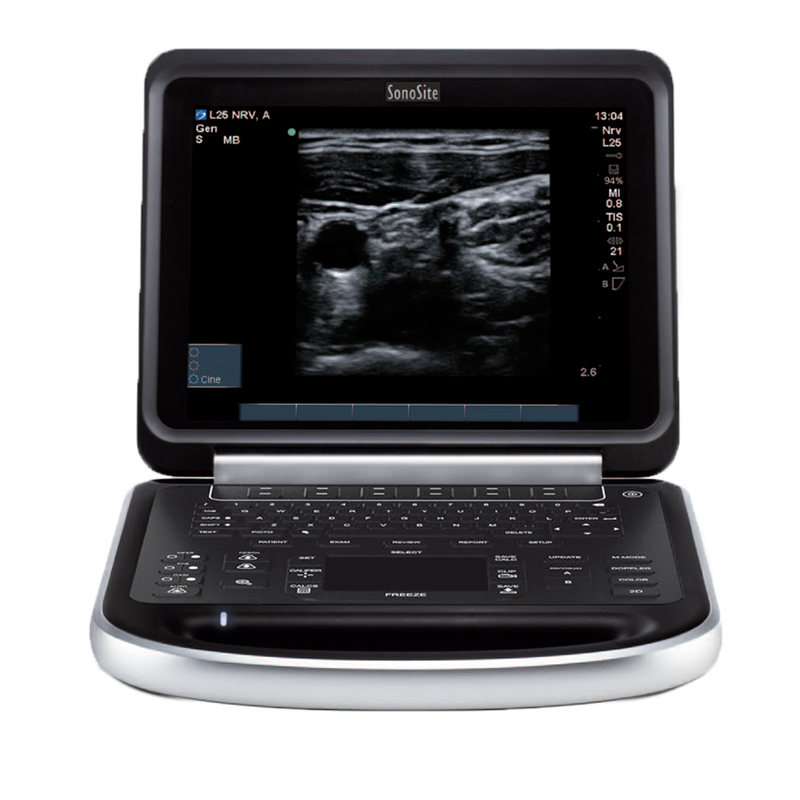 Fujifilm Sonosite Edge