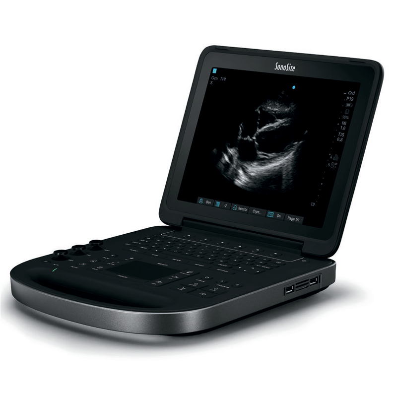 Fujifilm Sonosite Edge II