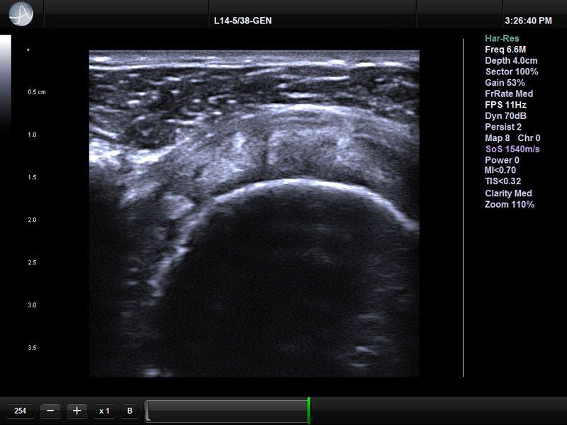 UltraSonix SonixOP
