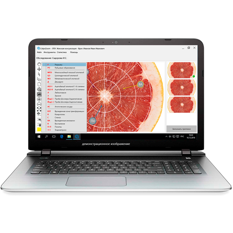 Topmed Компьютерная станция для кольпоскопической диагностики