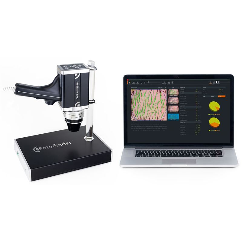 FotoFinder Dermoscope components USB