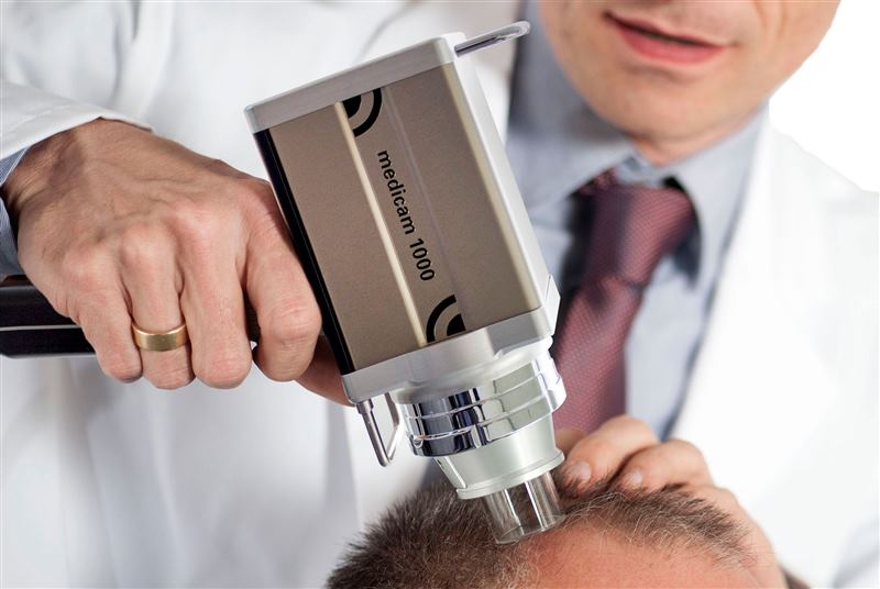 FotoFinder Trichovision