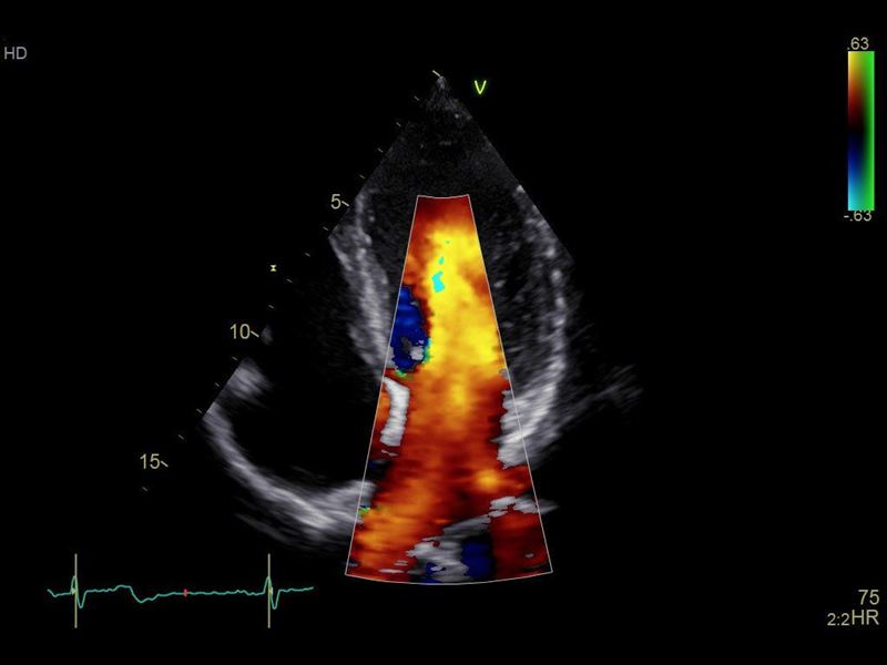 GE Healthcare Vivid S70
