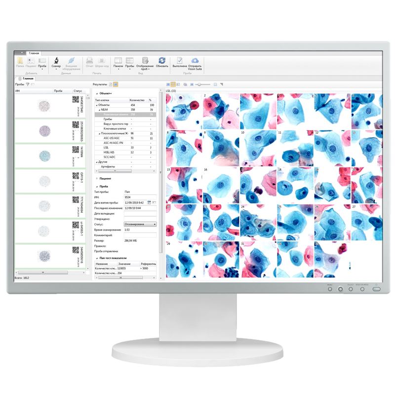 West Medica Vision Cyto Pap