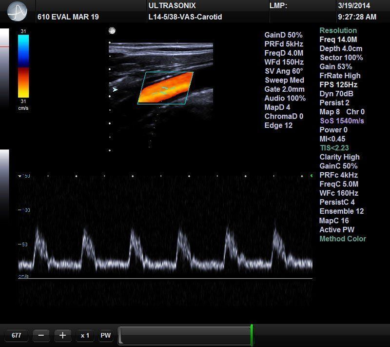 UltraSonix SonixTablet