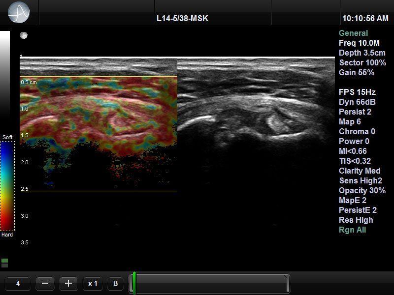 UltraSonix SonixTablet