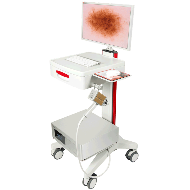 FotoFinder Dermoscope Vexia