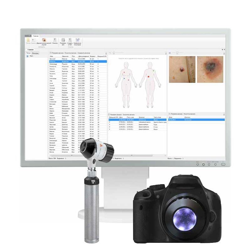 Heine Vision Derma