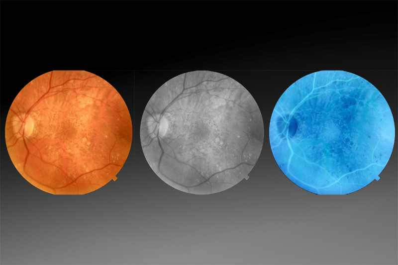 Optovue SOLIX