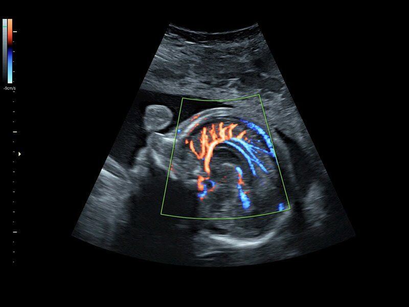 GE Healthcare Voluson S8