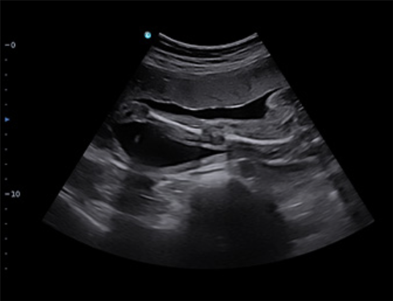 Chison Sonoair