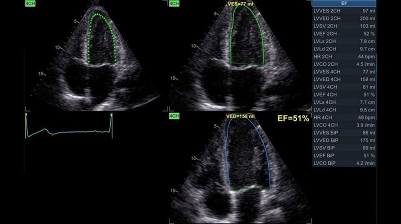 GE Healthcare Vivid T8